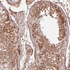 Immunohistochemical staining of human testis shows strong membranous positivity in cells in seminiferous ducts.