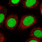 Immunofluorescent staining of human cell line MCF7 shows localization to nucleus.
