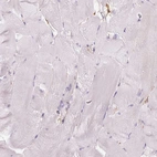 Immunohistochemical staining of human skeletal muscle shows no positivity in myocytes as expected.