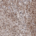 Anti-TPRKB Antibody