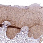 Immunohistochemical staining of human skin shows moderate cytoplasmic positivity in squamous epithelial cells.