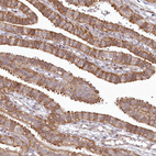 Immunohistochemical staining of human fallopian tube shows moderate cytoplasmic positivity in glandular cells.