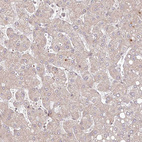 Immunohistochemical staining of human liver shows only very weak cytoplasmic positivity in hepatocytes.