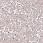 Immunohistochemical staining of human liver shows only very weak cytoplasmic positivity in hepatocytes.