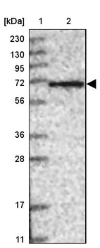 Lane 1: Marker [kDa] 230, 130, 95, 72, 56, 36, 28, 17, 11_br/_Lane 2: Human cell line RT-4