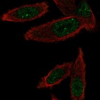 Anti-GEMIN6 Antibody