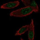 Anti-GEMIN6 Antibody
