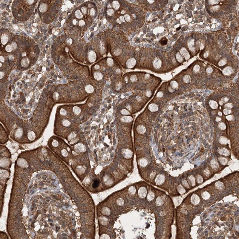 Anti-UNC93A Antibody