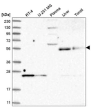 Western blot analysis in human cell line RT-4, human cell line U-251 MG, human plasma, human liver tissue and human tonsil tissue.