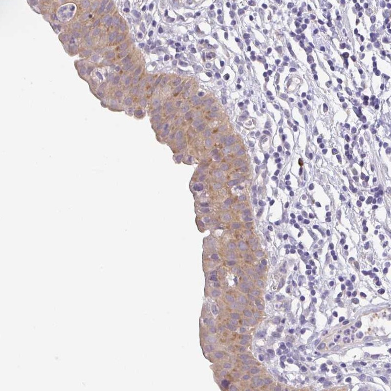 Anti-BCL2L1 Antibody