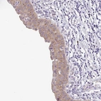 Anti-BCL2L1 Antibody