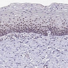 Anti-NIFK Antibody