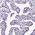 Immunohistochemical staining of human fallopian tube shows strong nucleolar positivity in glandular cells.