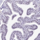 Immunohistochemical staining of human fallopian tube shows strong nucleolar positivity in glandular cells.