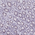 Immunohistochemical staining of human small intestine shows strong nucleolar positivity in glandular cells.