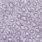 Immunohistochemical staining of human small intestine shows strong nucleolar positivity in glandular cells.