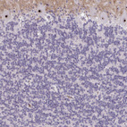 Immunohistochemical staining of human cerebellum shows strong nucleolar positivity in Purkinje cells.