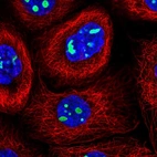 Immunofluorescent staining of human cell line A-431 shows localization to nucleoli.