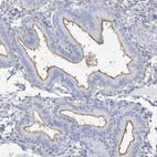 Immunohistochemical staining of human endometrium shows weak to moderate positivity in luminal membrane in glandular cells.