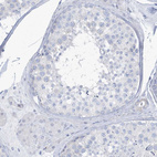 Immunohistochemical staining of human testis shows no cytoplasmic positivity in cells in seminiferous ducts as expected.