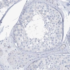 Immunohistochemical staining of human testis shows no cytoplasmic positivity in cells in seminiferous ducts as expected.
