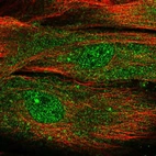 Immunofluorescent staining of human cell line BJ shows localization to nucleoplasm & cytosol.