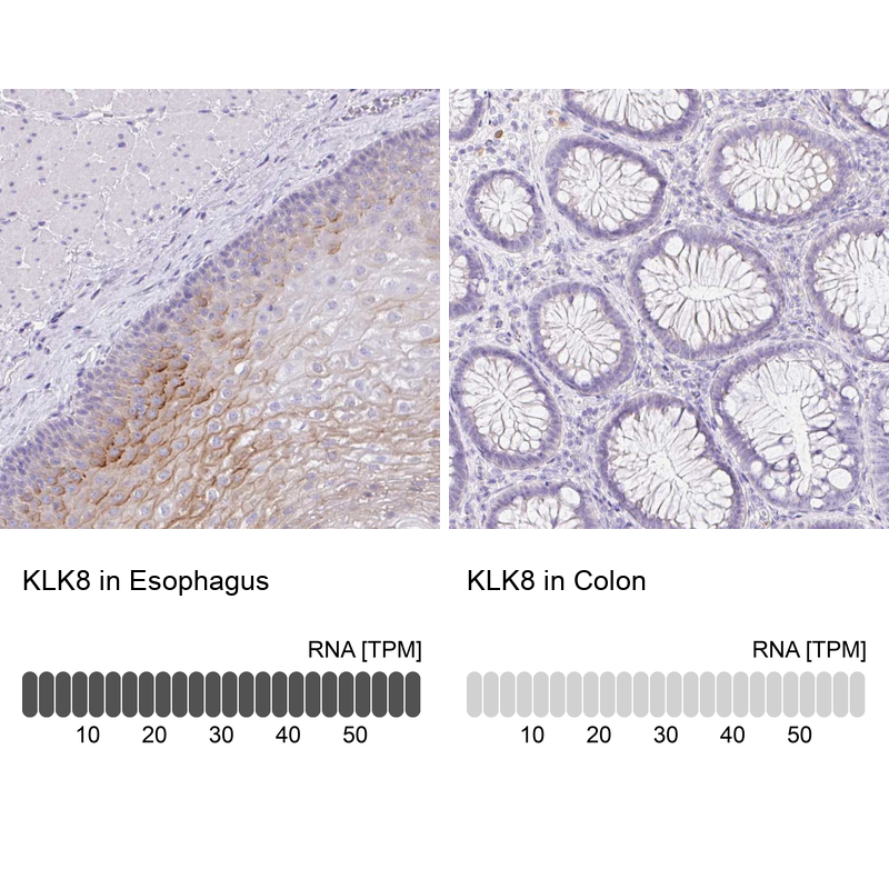 Anti-KLK8 Antibody