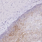 Immunohistochemical staining of human esophagus shows high expression.
