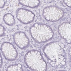 Immunohistochemical staining of human colon shows low expression as expected.