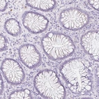 Immunohistochemical staining of human colon shows low expression as expected.