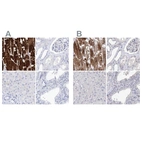 Immunohistochemical staining of human heart muscle, kidney, liver and prostate using Anti-MYOZ2 antibody HPA035764 (A) shows similar protein distribution across tissues to independent antibody HPA035763 (B).