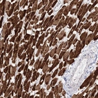Immunohistochemical staining of human heart muscle shows high expression.