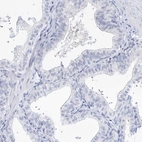 Immunohistochemical staining of human prostate shows low expression as expected.