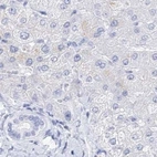 Immunohistochemical staining of human liver using Anti-MYOZ2 antibody HPA035764.