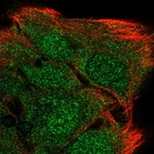 Immunofluorescent staining of human cell line SK-MEL-30 shows localization to nucleus & cytosol.
