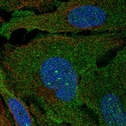 Anti-ARHGAP19 Antibody