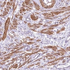 Anti-DPP3 Antibody
