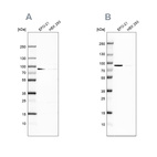 Western blot analysis using Anti-DPP3 antibody HPA035780 (A) shows similar pattern to independent antibody HPA035781 (B).