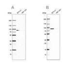 Western blot analysis using Anti-DPP3 antibody HPA035780 (A) shows similar pattern to independent antibody HPA035781 (B).