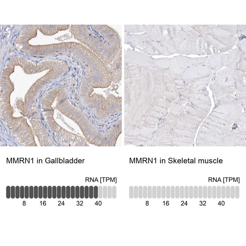 Anti-MMRN1 Antibody