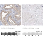 Anti-MMRN1 Antibody