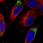 Immunofluorescent staining of human cell line U-251 MG shows localization to cytosol.