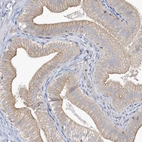 Immunohistochemical staining of human gallbladder shows high expression.