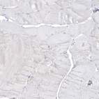 Immunohistochemical staining of human skeletal muscle shows low expression as expected.