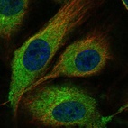 Immunofluorescent staining of human cell line HUVEC TERT2 shows localization to endoplasmic reticulum.