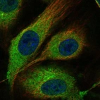 Immunofluorescent staining of human cell line HUVEC TERT2 shows localization to endoplasmic reticulum.