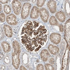 Anti-ZNF16 Antibody