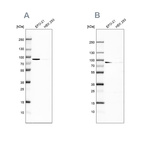 Western blot analysis using Anti-DPP3 antibody HPA035781 (A) shows similar pattern to independent antibody HPA035780 (B).