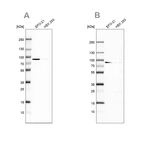 Western blot analysis using Anti-DPP3 antibody HPA035781 (A) shows similar pattern to independent antibody HPA035780 (B).