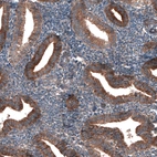 Immunohistochemical staining of human endometrium shows strong cytoplasmic positivity in glandular cells.